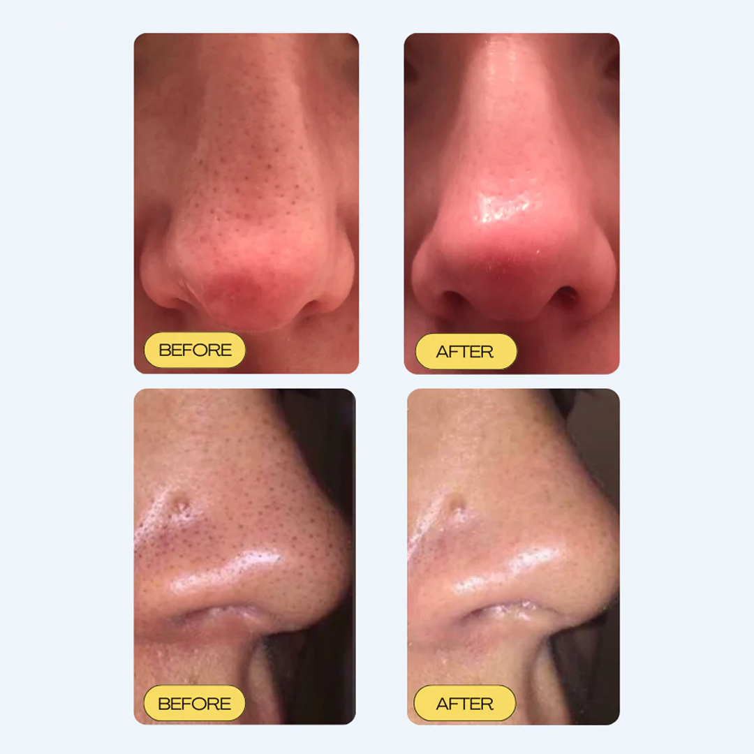 PORE PERFECT BY OVATA®